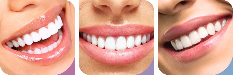 Sorrisos transformados na Linhart Dental Care em São Bernardo do Campo