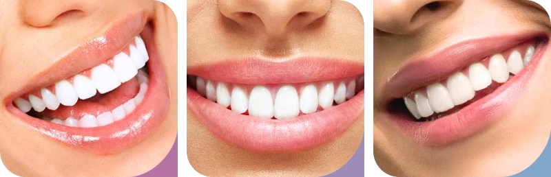 Sorrisos transformados na Linhart Dental Care em São Bernardo do Campo